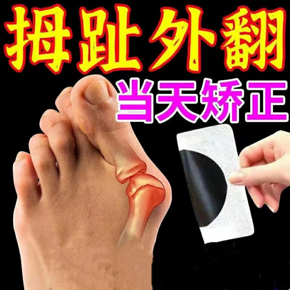 ㊙【早用早好】拇指外翻按摩器材