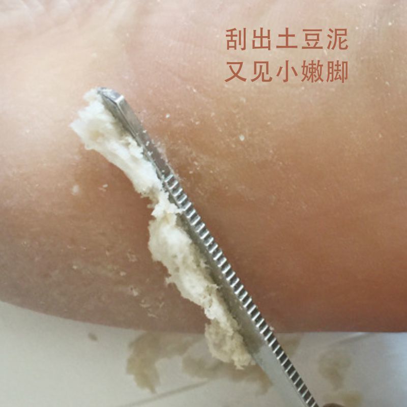 刮脚刀+磨脚器去老茧死皮家用