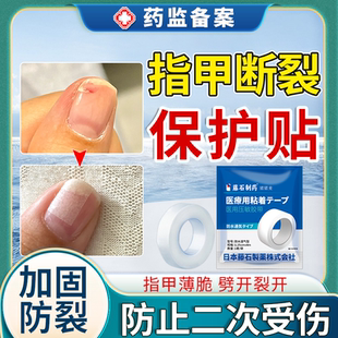 指甲劈了断裂劈裂手指甲盖受伤边缘裂口开裂护甲套保护贴医用级JW