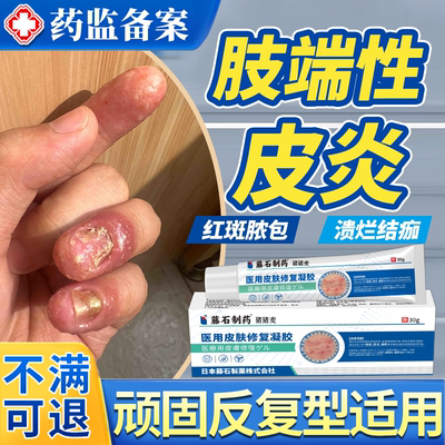 肢端性皮炎脓包糜烂脱皮专用膏