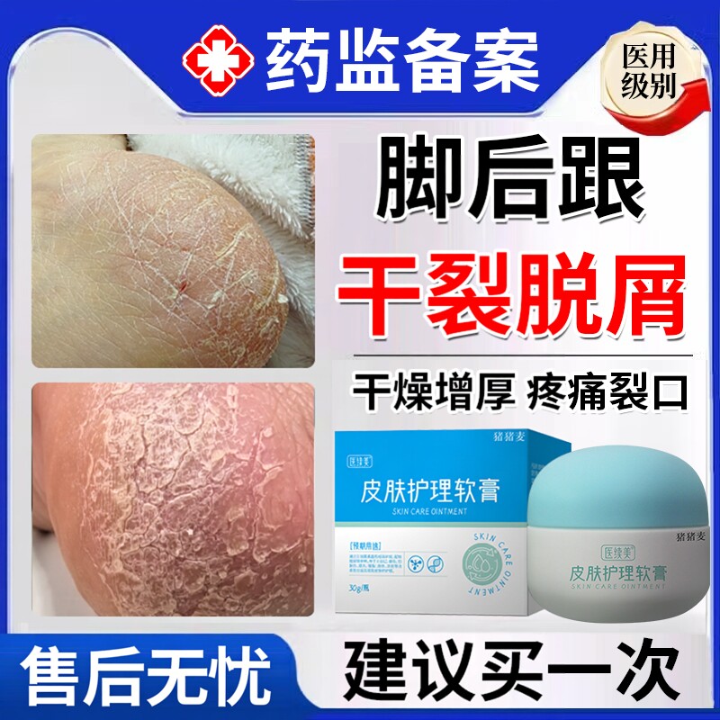 脚后跟干裂起硬皮足跟开裂脚膜去死皮真菌感染角化型脚气修复霜EM