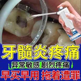 牙髓炎杀死牙神经疼痛特牙疼效专用搭治疗的药房口腔修复液喷剂OZ