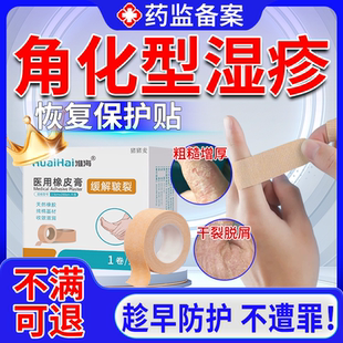 手指角化型湿疹保护贴手部癣脱皮干裂真菌感染皲裂预防护手足膏EM