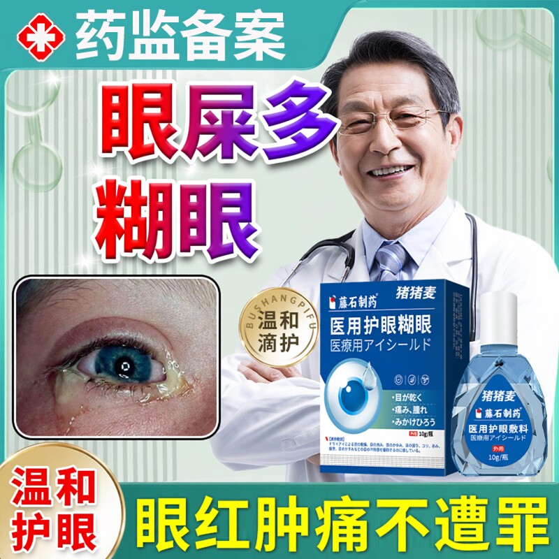 泪囊炎泪腺堵塞泪阜囊肿眼屎多可搭眼药水粘稠拉丝眼睛上火流OZ