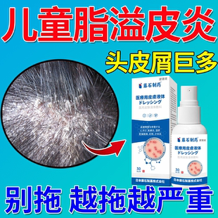 儿童头皮屑脂溢性皮炎多真菌感染头癣毛囊炎洗发水头部专用喷剂JW