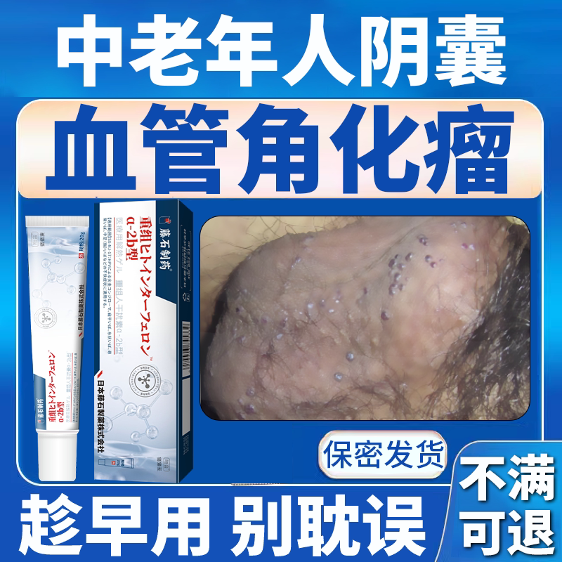 阴囊血管角化瘤红斑睾丸湿疹瘙痒疼痛蜘蛛痣去除红痣药房同款膏em