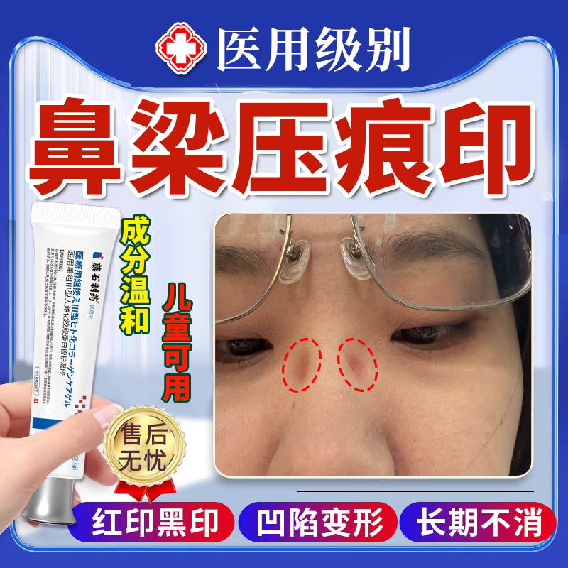 【医用级】祛鼻梁压痕红印黑印图片