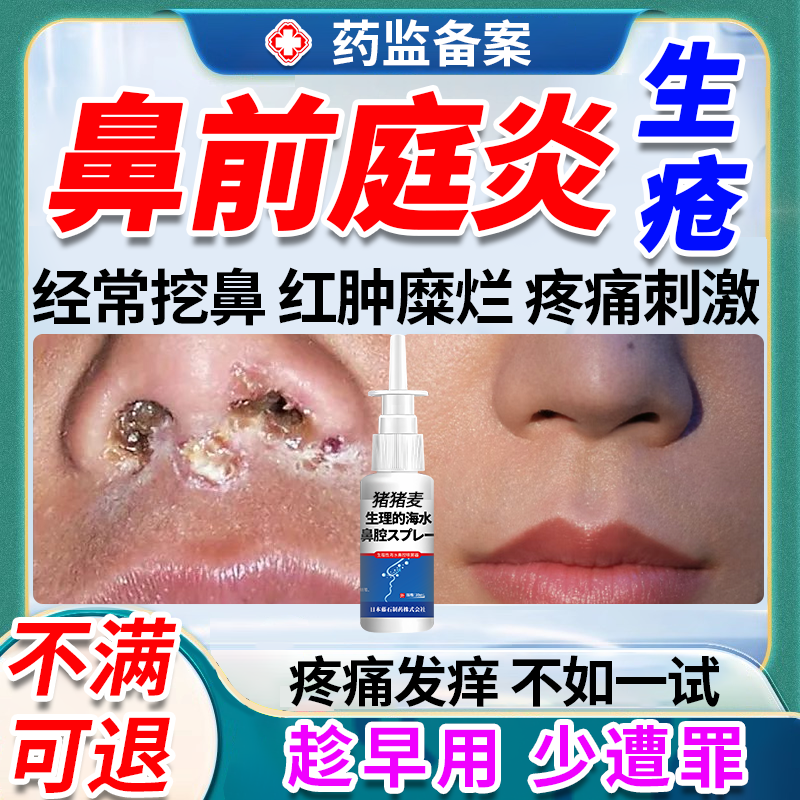 鼻前庭炎症鼻子结痂生疮疖肿囊肿修鼻黏膜复膏药贴鼻腔溃疡喷雾OZ,医疗器械,洗鼻器／吸鼻器,淘宝优惠券,粉丝福利购,淘宝优惠卷