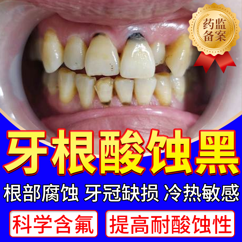 牙齿根部腐蚀牙根发黑牙菌斑去祛除神器非牙膏护牙素缝隙牙龈黑JW