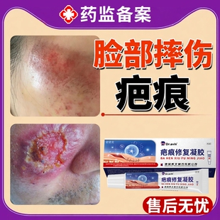 医用摔伤祛疤膏擦伤疤痕修复产品去疤痕除疤膏非第一名专用脸部DZ