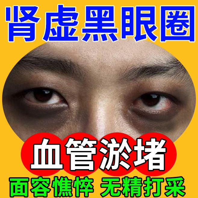 肾虚黑眼圈去除神器特别严重黑色素沉淀药房款膏强力血管型眼贴EM