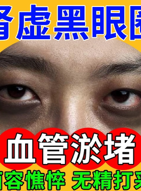 肾虚黑眼圈去除神器特别严重黑色素沉淀药房款膏强力血管型眼贴EM