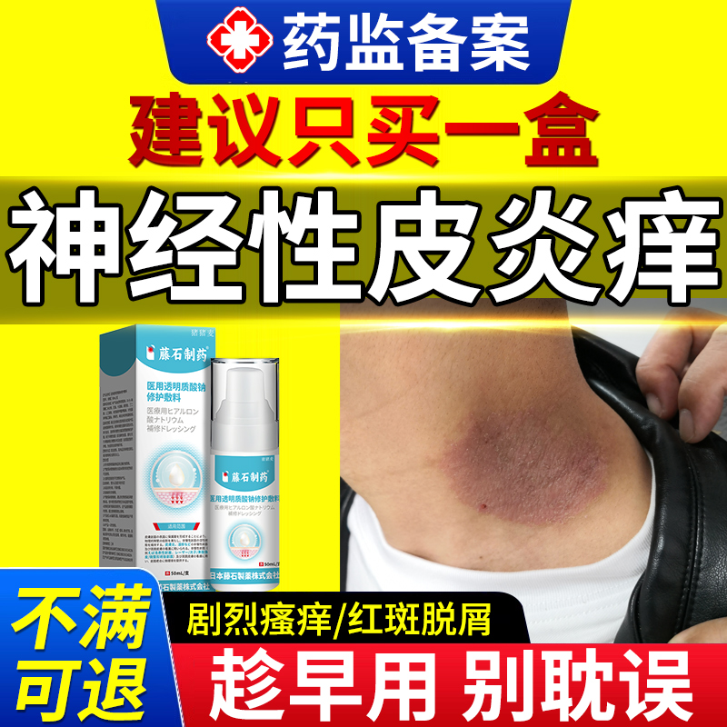 【现货速发】神经性皮炎瘙痒顽固