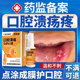 口腔溃疡棉签一点灵棒棉专非用可搭药搭口疮溃疡贴漱口水含漱液OZ