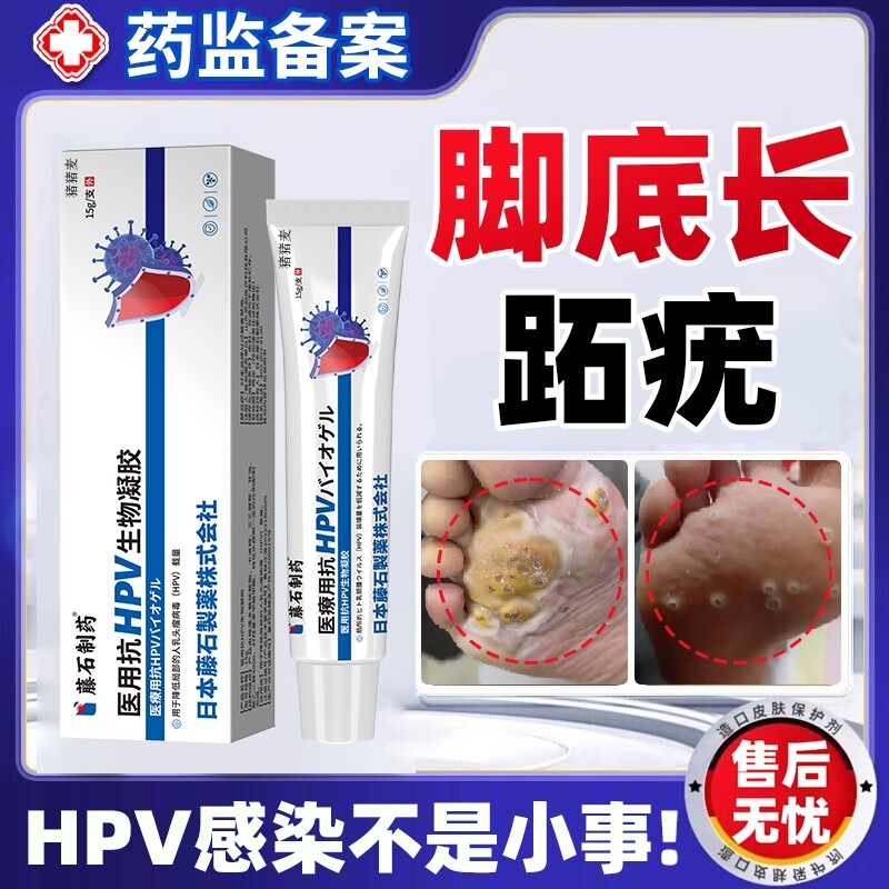 跖疣专用膏去除血胞刺去鸡眼石疣脚底趾疣拓清蚩尤必净敷料根足EM