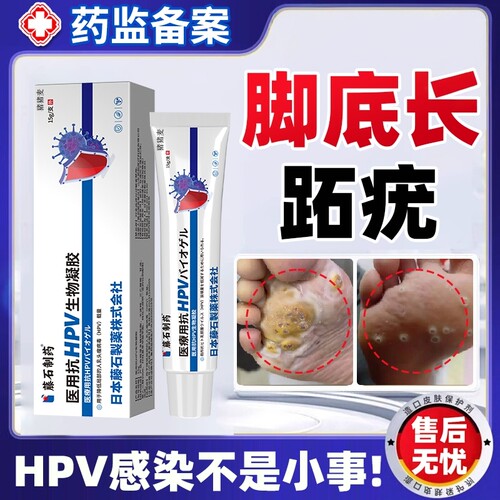 针对脚部跖疣【不满可退】