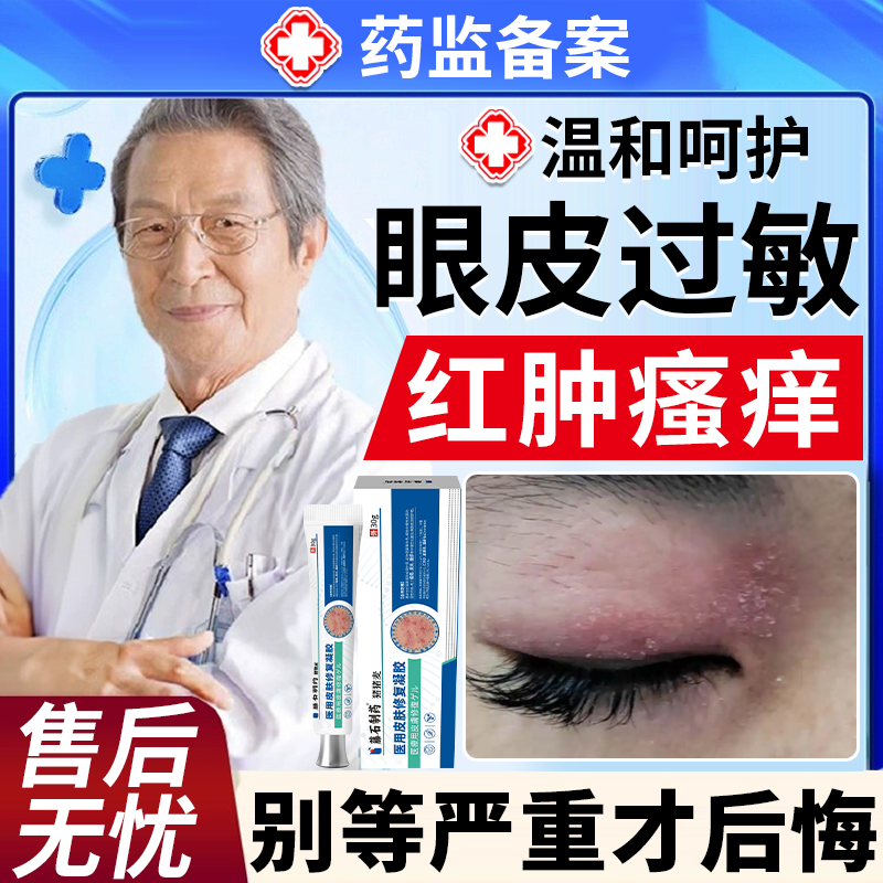 眼皮癣红肿痒眼睛周围过敏眼角痒干燥起皮掉屑神经性皮炎止痒膏BS