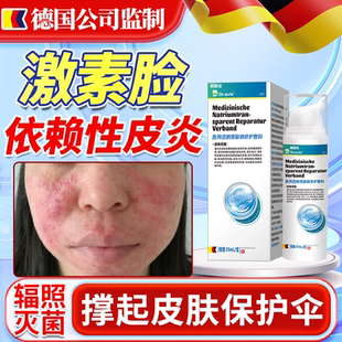 激素脸依赖性皮炎修复护肤品面部过敏皮肤屏障受损红疹痒红血丝JW