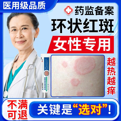 女性离心性环形红斑【温和不刺激