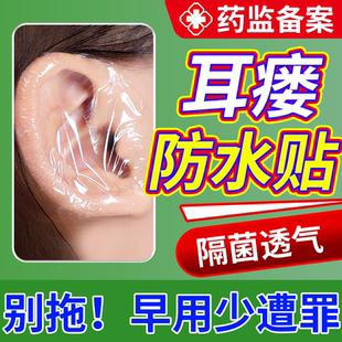 耳前瘘管耳仓防水贴纸清理工具发炎流脓药房款耳朵术后保护膏贴DZ