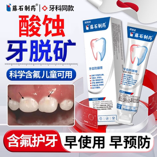 酸蚀牙齿脱矿白斑专用护牙素含氟修复再矿化可搭牙膏儿童青少年OZ