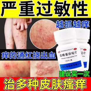 盐酸赛庚啶片湿疹荨麻疹过敏止痒皮炎药膏老年人皮肤瘙痒药非特效
