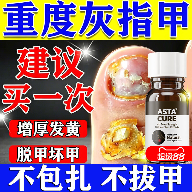 灰指甲专用药灰指甲抑菌液第一名保健理疗