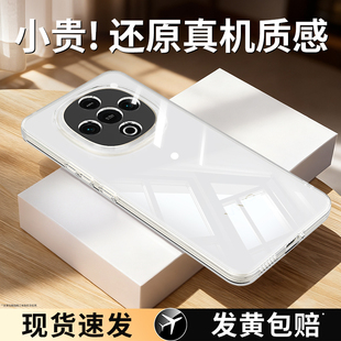 适用vivoY300手机壳Y300GT新款 Y300T透明保护套vivo硅胶Y300i全包防摔C超薄vivov软外壳男vovoy女viv0丫viviy