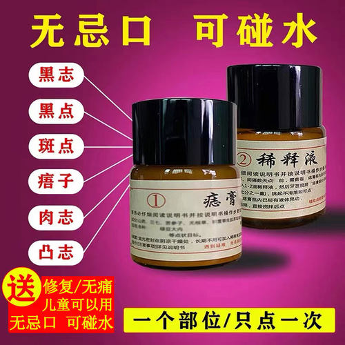 点痣膏无痕药水正品脸部祛痣膏点痦子取去痣黑痣不留疤神器
