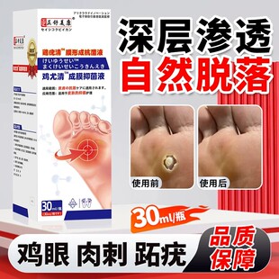 鸡尤清成膜抑菌液正舒美康鸡眼肉刺老茧抑菌液瘘子老茧正品康必健
