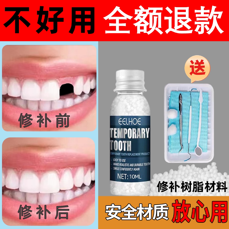 英国进口补神器牙自己在家牙齿洞膏牙缝材料牙套填充假牙齿缝隙
