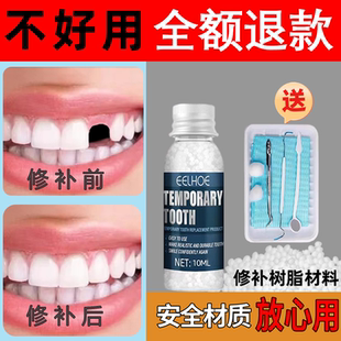 英国进口补神器牙自己在家牙齿洞膏牙缝材料牙套填充假牙齿缝隙