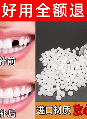 进口牙材料修补神器自己补永久假牙套牙临时仿真牙齿缺牙填充修复