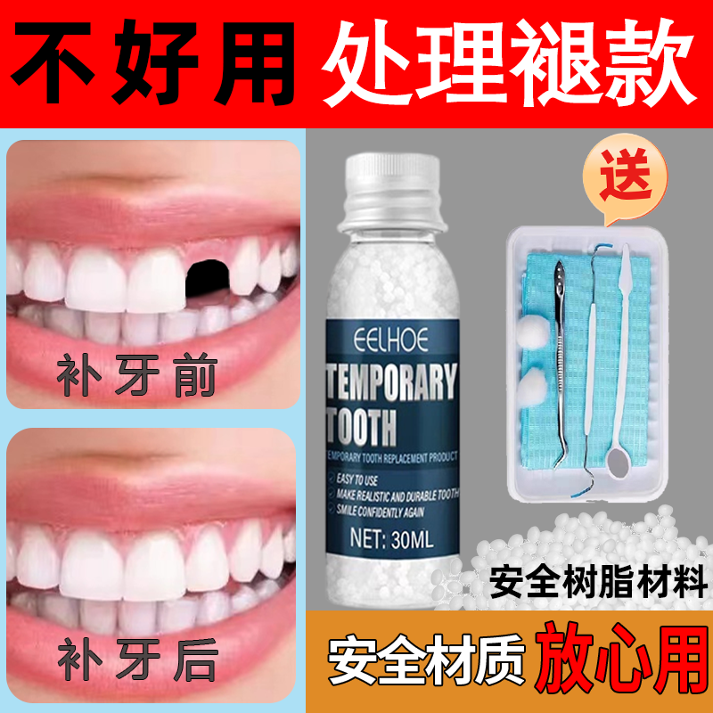 英国进口补牙神器自己在家补牙材料永久假牙套牙仿真牙齿缺牙修复