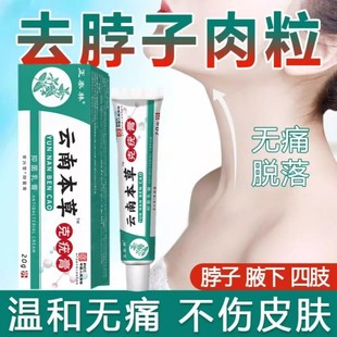 云南本草克疣膏正品去疣药膏尤瘊子小肉粒一抹无忧寻常疣去除神器