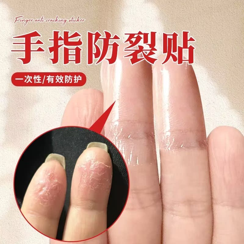 手指防裂贴防过敏保护套
