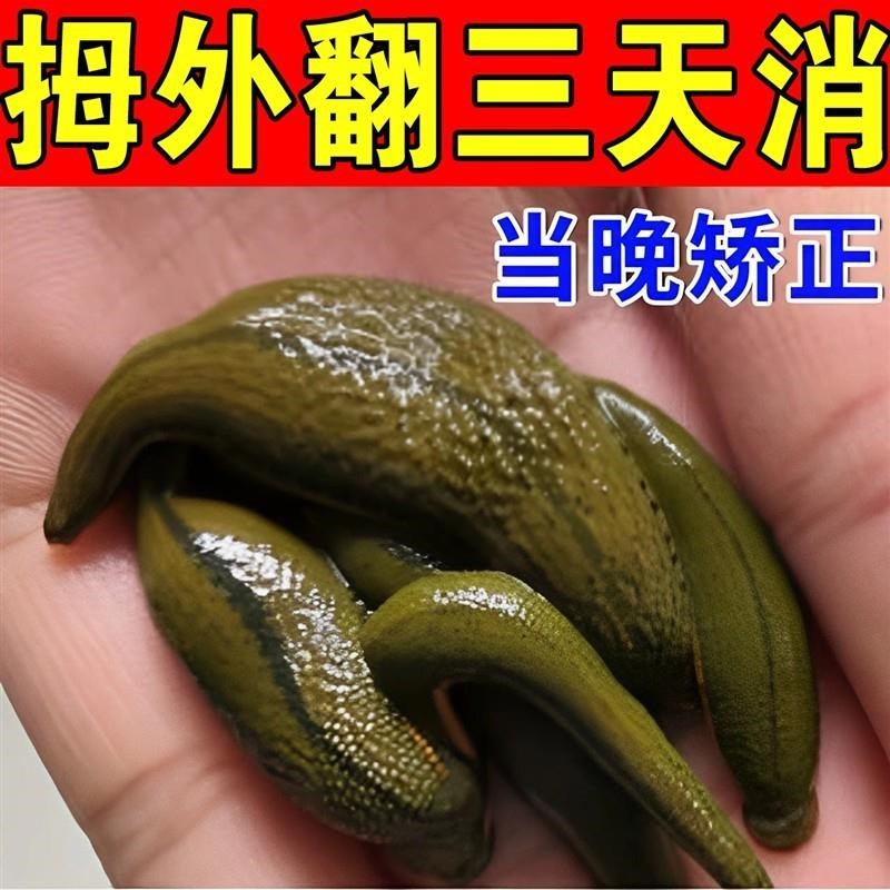 拇指外翻贴大脚骨矫正神器脚趾重叠防磨脚趾变形疼痛贴