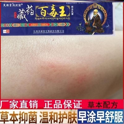红火蚁蚂蚁咬伤药膏蚊虫叮咬隐翅虫毒虫跳蚤螨虫叮咬瘙痒消肿外用