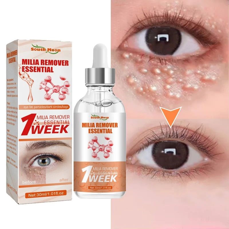 Fat Granules Removal Eye Serum Eye Milia Repair Treatment Pr