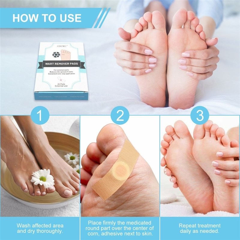 Foot Corn Removal Plaster Warts Thorn Remove patch 鸡眼膏贴