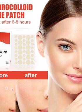 144pcs/set Face Men Women Skin Care Acne Pimple Patch Remove
