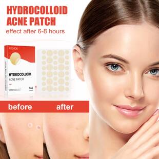 144pcs/set Face Men Women Skin Care Acne Pimple Patch Remove