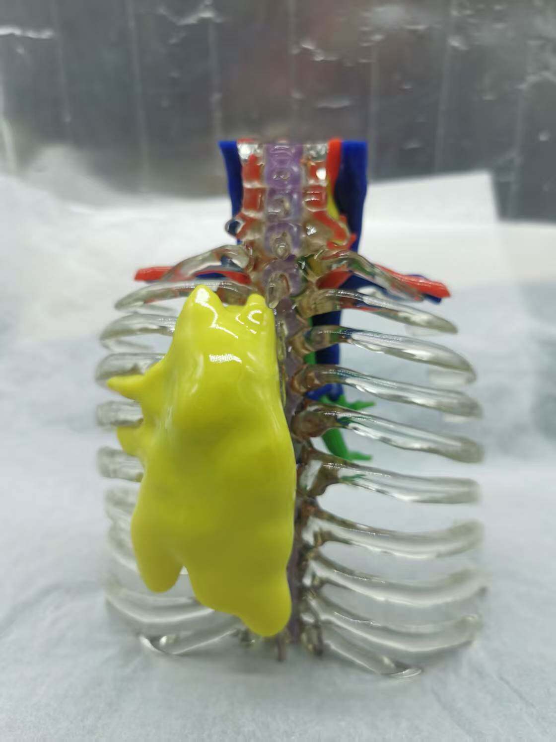全彩色3D打印服务个性化定制医疗展示模型肿瘤病变肝脏心脏齿科等