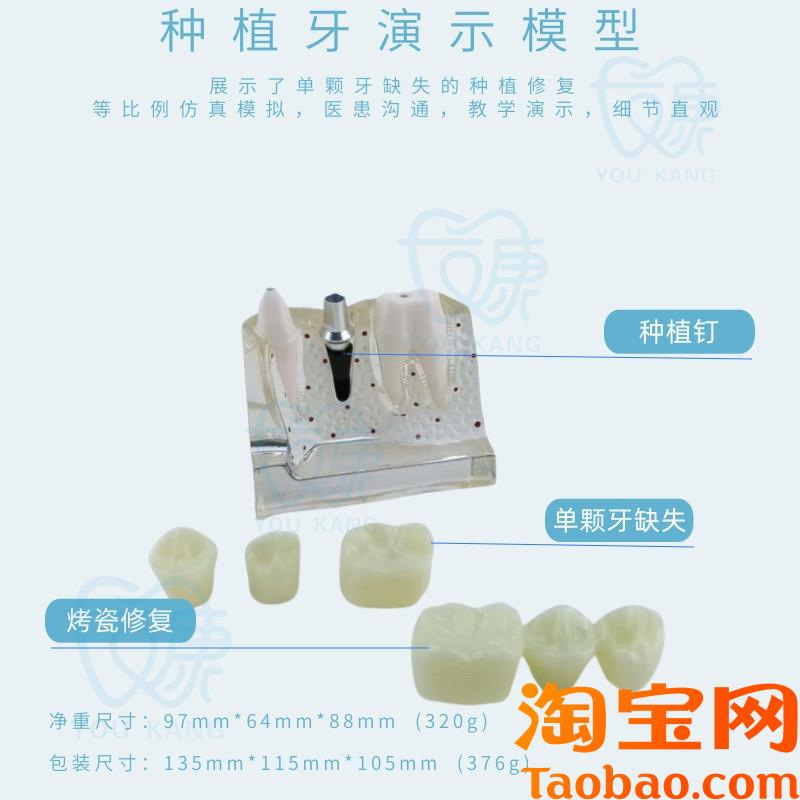 原装适用牙科种植牙模型模拟仿真口腔教学模型种植牙可拆卸牙齿厂