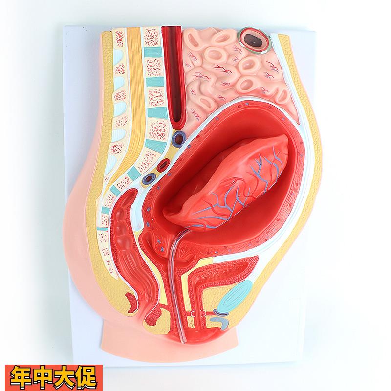 ENOVO颐诺胎盘剥离模型模型组织胚胎胎儿妇产科教学placenta培训