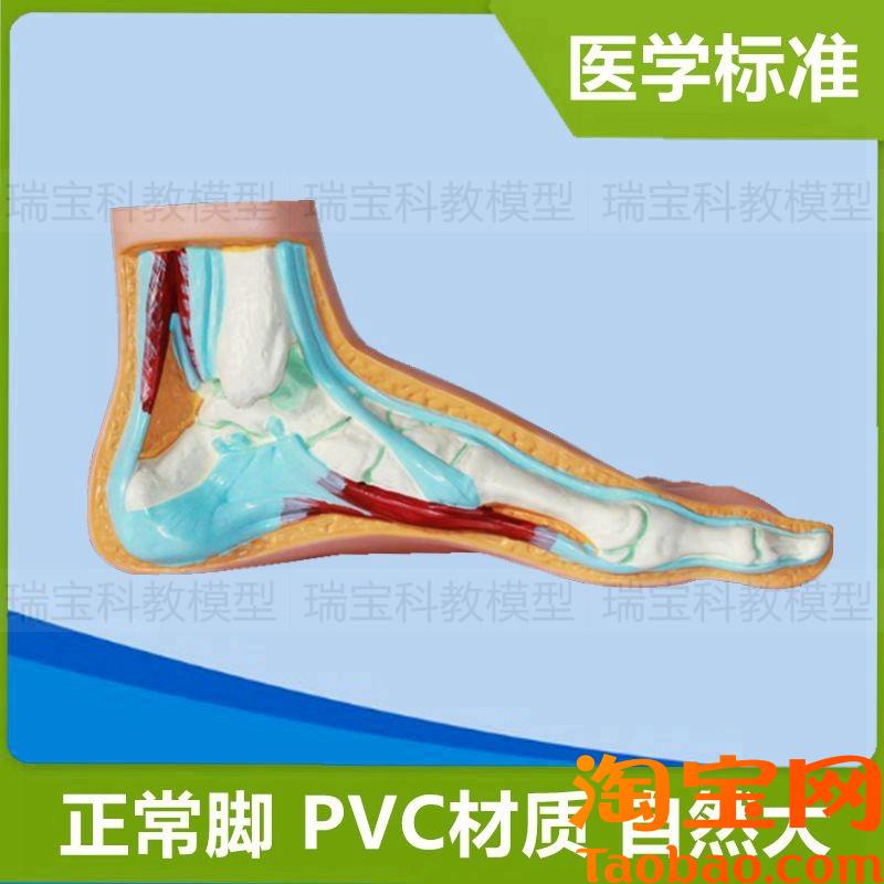 人体脚解剖模型正l常与畸形扁平足弓形踝关节脚骨关节仿真1:1比例