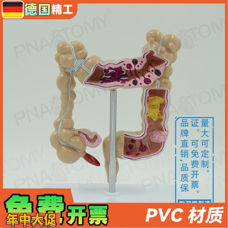 德国】仿真人体结肠大肠解剖模型肛肠科肠道肠胃消化系统教学