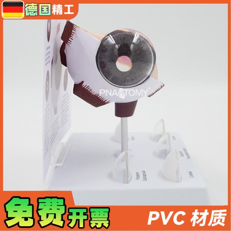 原装适用德国】眼球模型病理眼球演示教具眼科展示礼品人体器官解