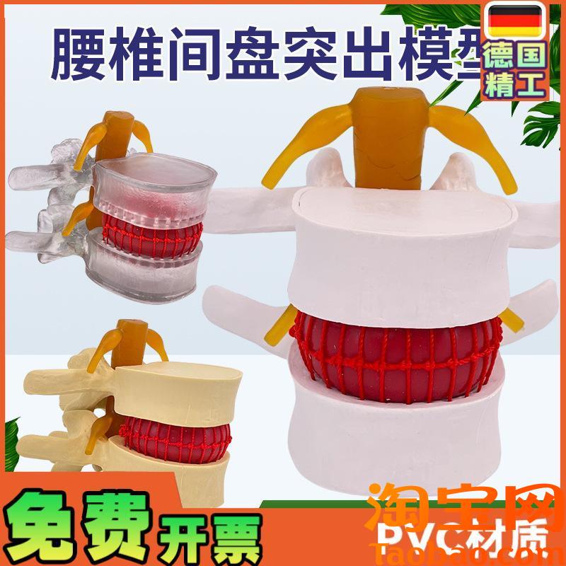 原装适用腰椎模型教学医学人体腰椎间盘受压演示脊柱骨突出病理骨