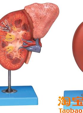肾脏与肾上腺放大模型/解剖模P型A14006